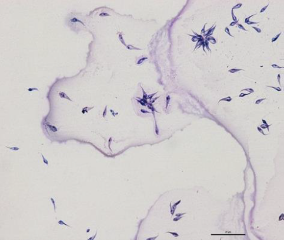 Imagen de protozoos tripanosomátidos